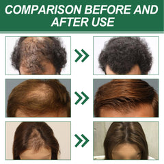Anti-Hair Loss & Strengthening Massage Hair Care Solution