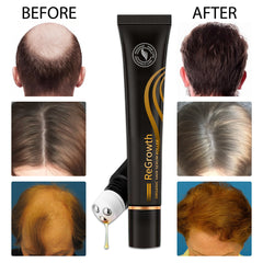 Revita Roll Organic Hair Regrowth Serum Set