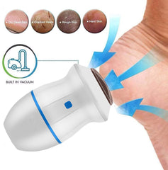 Vacuum Smooth Electric Foot Grinder