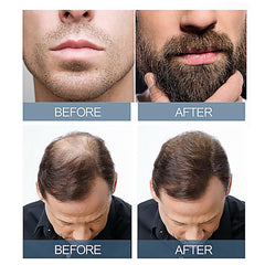 Scalp Revive Moisturizing Hair Root Care Solution