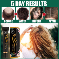 Revita Roll Organic Hair Regrowth Serum Set